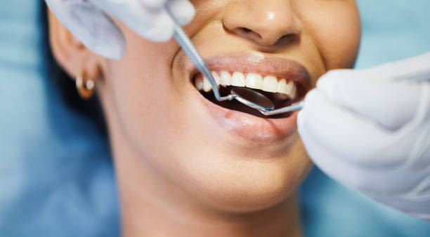 Best Emergency Dental Care for Abscessed Tooth in Dexter, NM